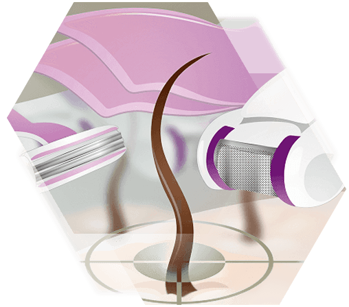classic hair removal methods illusration